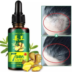 7 Days Hair Growth Germinal Serum Oil (30ml)